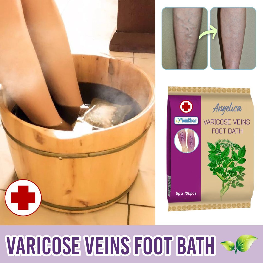 Angelica Foot Bath for Varicose Veins (100PCS)