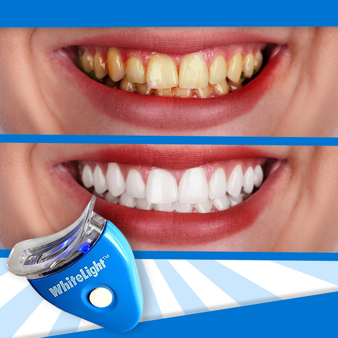 WhiteLight™ Teeth Whitening Device